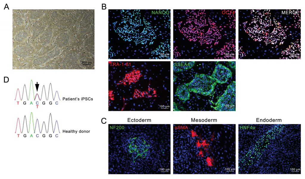 Long Qt Syndrome Zakian Lab Ipsc Collection