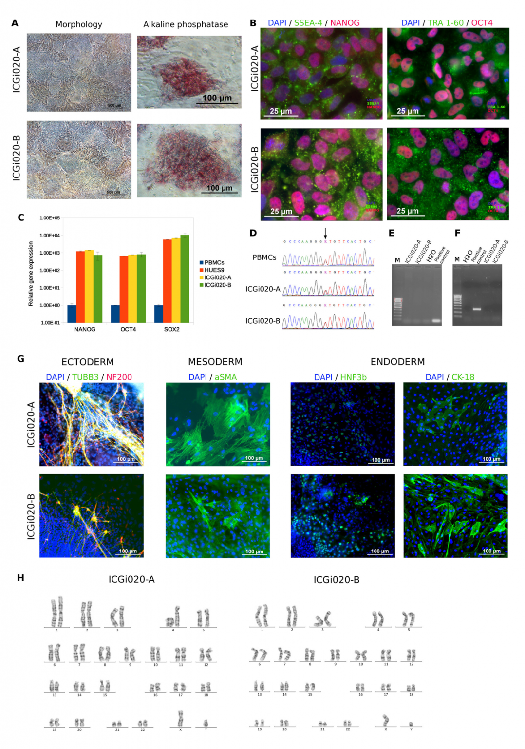Wilson’s disease Zakian Lab iPSC collection